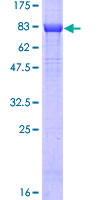 12.5% SDS-PAGE Stained with Coomassie Blue.